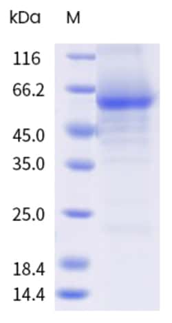 Sino Biological&nbsp;Recombinant Human SLC30A1 Protein (Nanodisc, His Tag) 500 µg