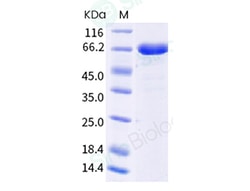 Sino Biological Recombinant Human Nectin-4 Protein (ECD, hFc Tag), HPLC-verified,