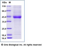 Sino Biological Human NECTIN4 / PVRL4 Protein (His Tag) 50ug, Quantity: