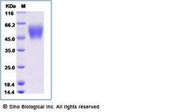 Sino Biological Human TPBG / 5T4 Protein (His Tag) 100ug, Quantity: Each