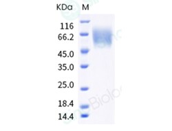 Sino Biological Human 5T4 / TPBG Protein (ECD, His Tag) 100ug, Quantity:
