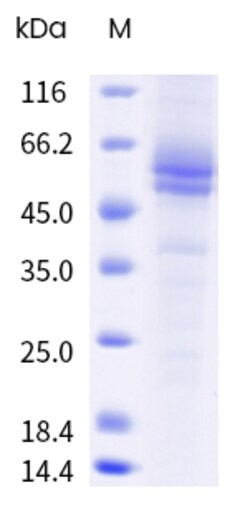 Sino Biological&nbsp;Recombinant Human SLC39A10 Protein (Nanodisc, His Tag) 100 µg