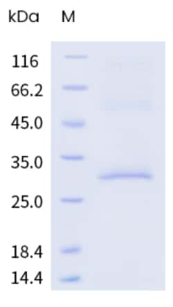 Sino Biological Human GPRC5D Protein 20ug (Sino Biological), Quantity:
