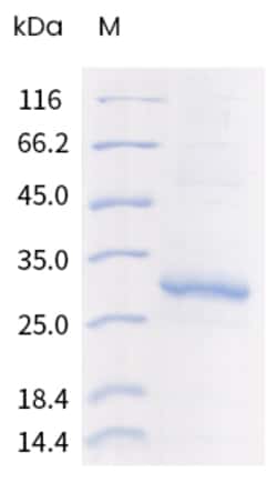 Sino Biological Human GPRC5D Protein 20ug (Sino Biological), Quantity: