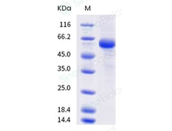 Sino Biological Protein Human PVRIG 100ug, Quantity: Each of 1