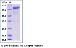 Sino Biological Human EGFR / HER1 / ErbB1 Protein (Isoform vIII, Fc Tag)