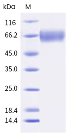 Sino Biological Recombinant Human EGFR Protein (Isoform vIII, His Tag),