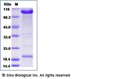 Sino Biological Recombinant Human PCSK9 Protein (mFc Tag) 500, Quantity: