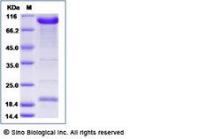Sino Biological Recombinant Human PCSK9 Protein (mFc Tag), Quantity: Each