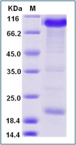 Sino Biological Human PCSK9 / NARC1 (D374Y) Protein (Fc Tag) 500µg, Quantity: