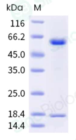 Sino Biological Recombinant Human PCSK9 Protein (D374Y, His Tag), HPLC-verified