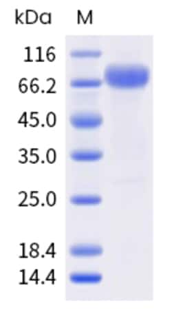 Sino Biological Human IL15RA Protein 20ug (Sino Biological), Quantity: