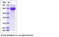 Sino Biological Human CRLF2 Protein (ECD, Fc Tag) 50ug, Quantity: Each