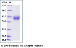 Sino Biological Human CRLF2 Protein (His Tag) 50ug, Quantity: Each of 1
