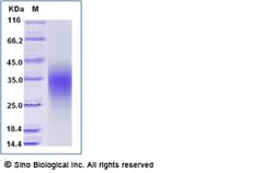 Sino Biological Recombinant Human CD79B Protein (ECD, His Tag), HPLC-verified,