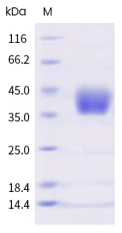Sino Biological Human B7-H3 / CD276 (isoform 2) Protein (ECD, His Tag)
