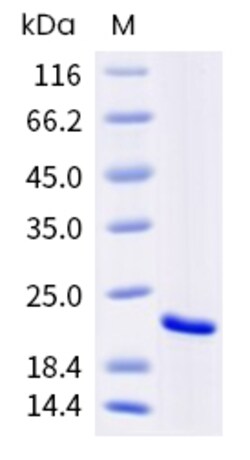 Sino Biological Human GPX4 Protein 1MG (Sino Biological), Quantity: Each