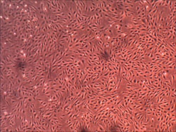 Cell Systems Corporation Primary Human Venous Endothelial Cells (HUVEC)
