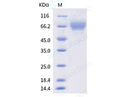 Sino Biological Recombinant Human ILT1/LILRA2/LIR-7 Protein (ECD, His Tag),