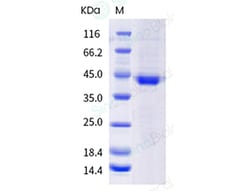Sino Biological Recombinant Human Cathepsin H Protein (His Tag), HPLC-verified,