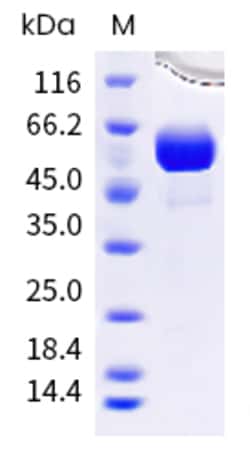 Sino Biological Human BTN1A1 Protein 100ug (Sino Biological), Quantity: