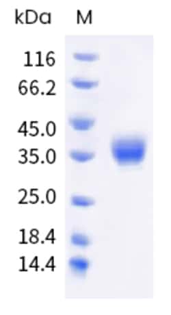 Sino Biological Human BTN1A1 Protein (ECD, His & AVI Tag), Biotinylated