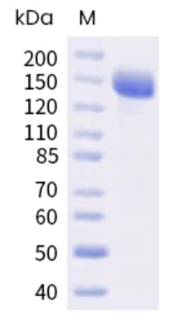 Sino Biological Human ROBO1 Protein 100ug (Sino Biological), Quantity:
