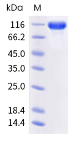 Sino Biological Human ROBO1 Protein 1MG (Sino Biological), Quantity: Each