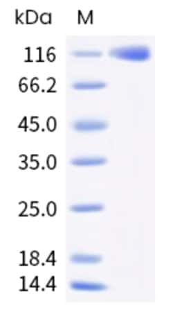 Sino Biological Human ROBO1 Protein 100ug (Sino Biological), Quantity: