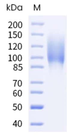 Sino Biological Human MUC16 Protein 1MG (Sino Biological), Quantity: Each