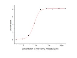 Sino Biological Human SSTR2 Protein 20ug (Sino Biological), Quantity: Each