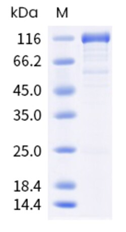 Sino Biological Human UBA6 Protein 500ug (Sino Biological), Quantity: Each