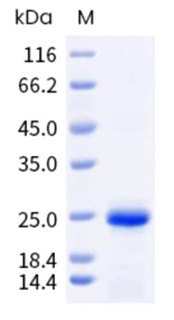 Sino Biological Fel d 1 Protein 250ug (Sino Biological), Quantity: Each