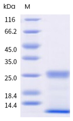 Sino Biological&nbsp;Recombinant Felis domesticus Fel d 1 Protein 250