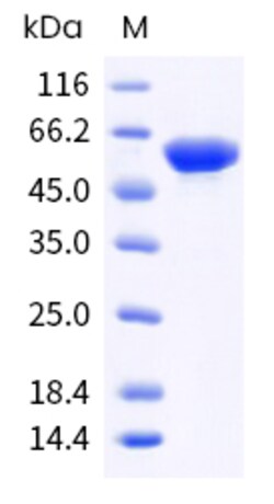 Human CES1 Protein 500ug (Sino Biological)