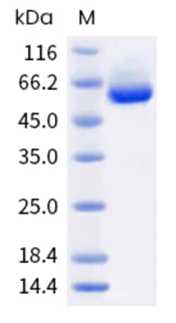 Sino Biological Recombinant Human Legumain Protein (His Tag), HPLC-verified,