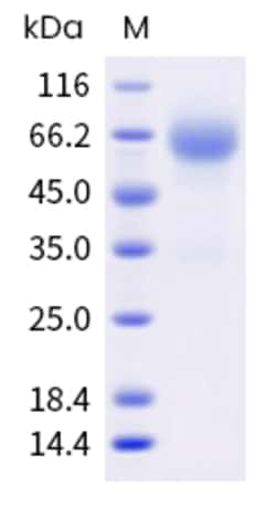 Sino Biological Human SIGLEC9 Protein 500ug (Sino Biological), Quantity: