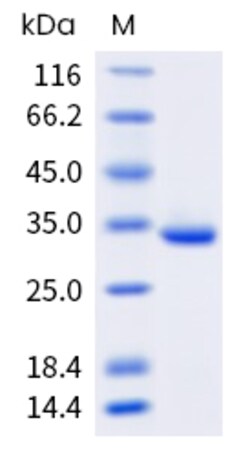 Sino Biological Human FASN Protein 500ug (Sino Biological), Quantity: Each