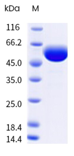 Sino Biological&nbsp;Recombinant Human LGR5 Protein (His Tag) 100