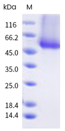 Sino Biological Recombinant Human MUC-1 Protein (His Tag), Quantity: Each