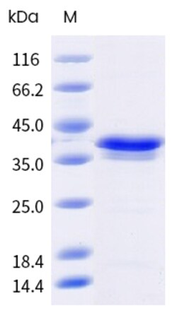 Sino Biological Ara h 3 Protein 250ug (Sino Biological), Quantity: Each