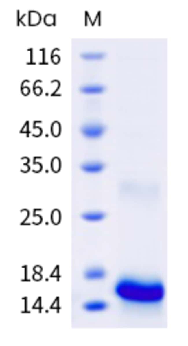 Sino Biological Brazil nut Ber e 1 Protein 250ug (Sino Biological 