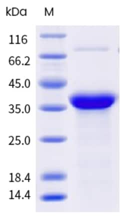 Sino Biological Bla g 7 Protein 250ug (Sino Biological), Quantity: Each