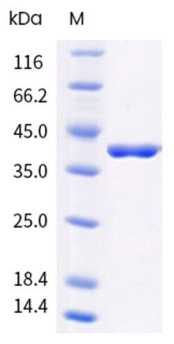 Sino Biological Bla g 9 Protein 250ug (Sino Biological), Quantity: Each