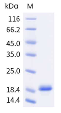 Sino Biological Asp f 15 Protein 250ug (Sino Biological), Quantity: Each