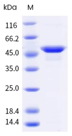 Sino Biological Asp f 22 Protein 250ug (Sino Biological), Quantity: Each