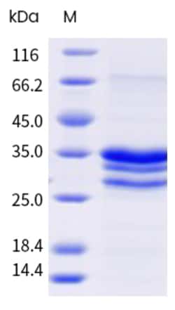 Sino Biological Recombinant Mugwort Art v 3 Protein (Art v 3.03), Quantity: