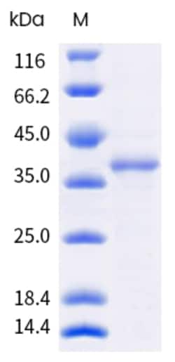 Sino Biological Bos domesticus Bos d 2 Protein 250ug (Sino Biological),