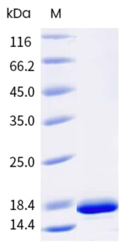 Sino Biological Rabbit Ory c 3 Protein 250ug (Sino Biological), Quantity: