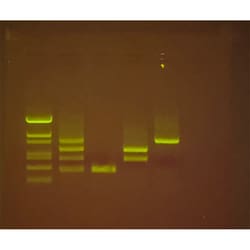 Edvotek&trade;&nbsp;Tick Talk: Tick-Borne Disease Diagnostics